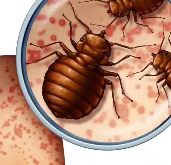 Si possono portare con sé le cimici dei letti?