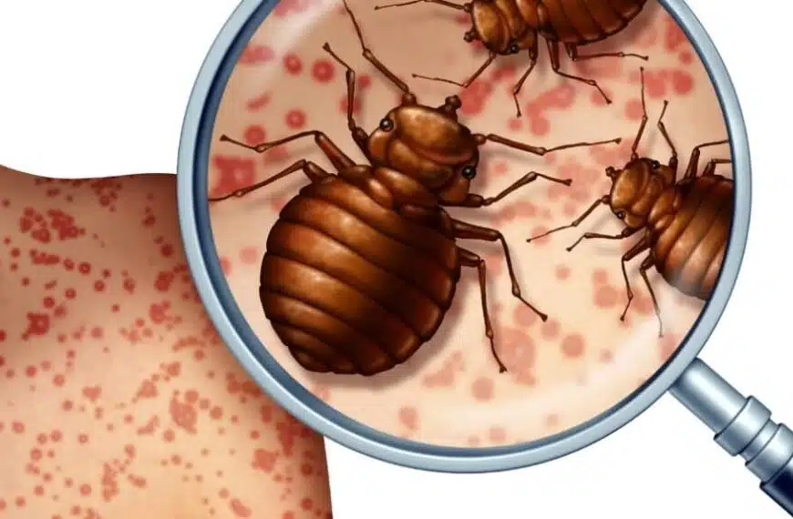 Si possono portare con sé le cimici dei letti?